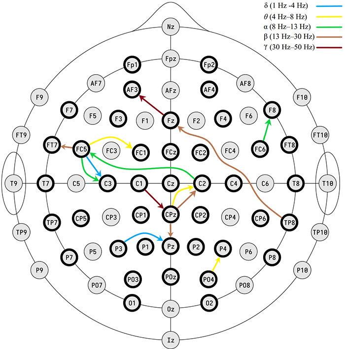 RavanBrainResearchMajorDepressiveDisorderElectrodes