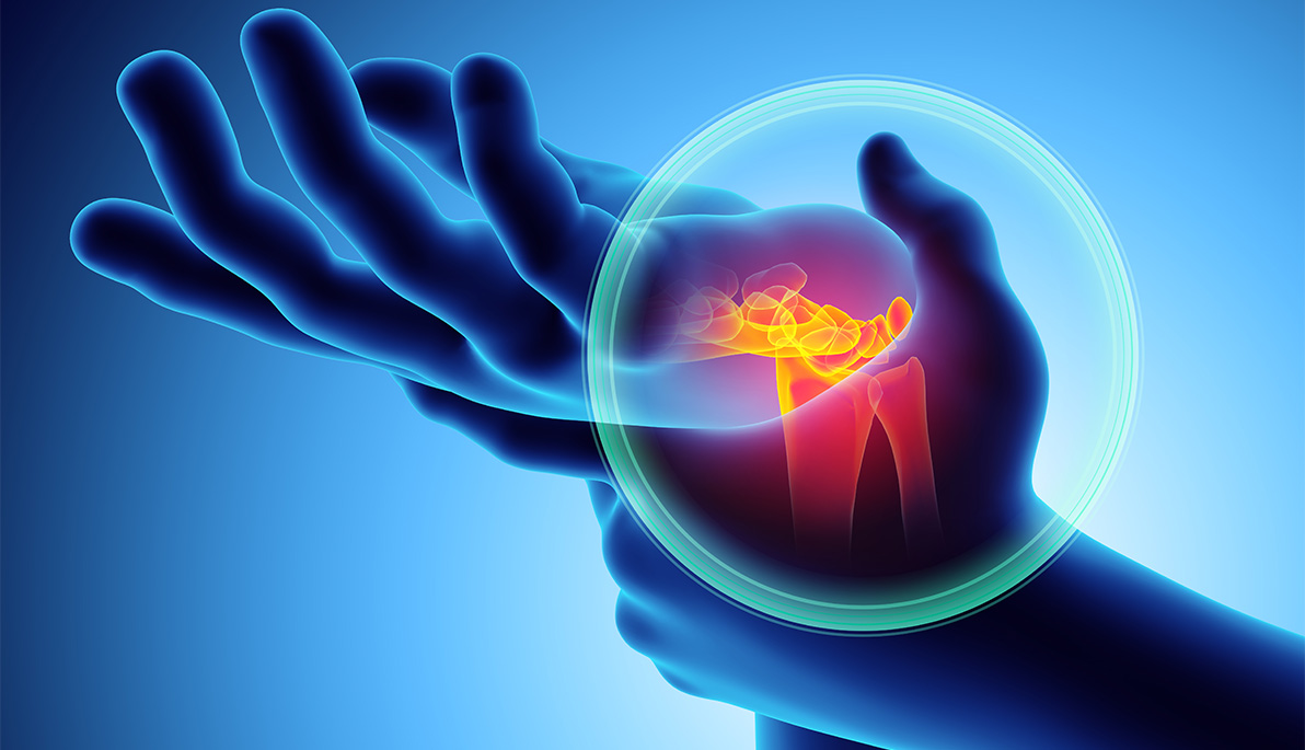 Illustration of an X-ray of a hand.