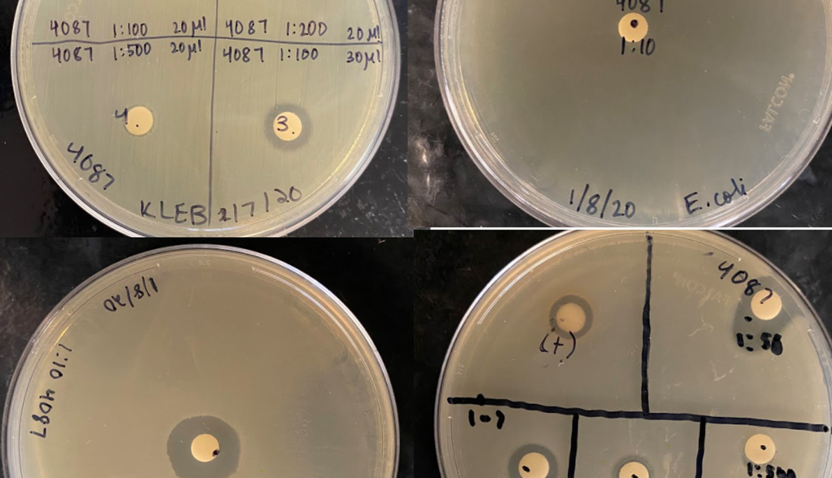 Kirby-Bauer disk-diffusion assay