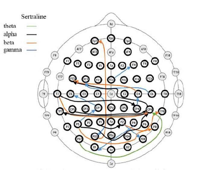 RavanBrainResearchSertralineResearch