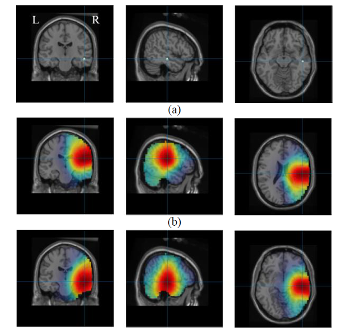 RavanBrainResearchSeizureResearchScans